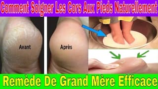 Comment Soigner Les Cors Aux Pieds Naturellement Remède De Grand Mère 1 iVDcLS